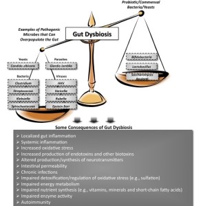 Gut-Dysbiosis-and-Irritable Bowel Syndrome