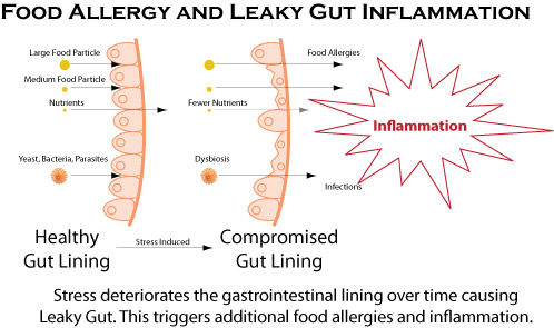 Gut Inflammation