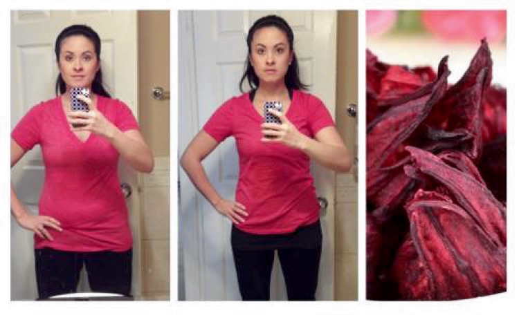 Body inflammation