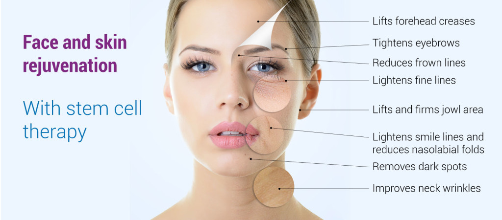 stem cell therapy 