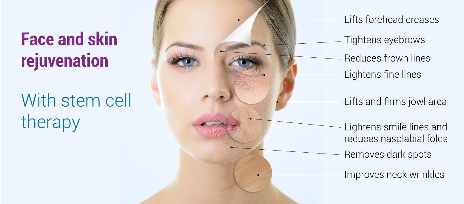 Vampire facelift applications