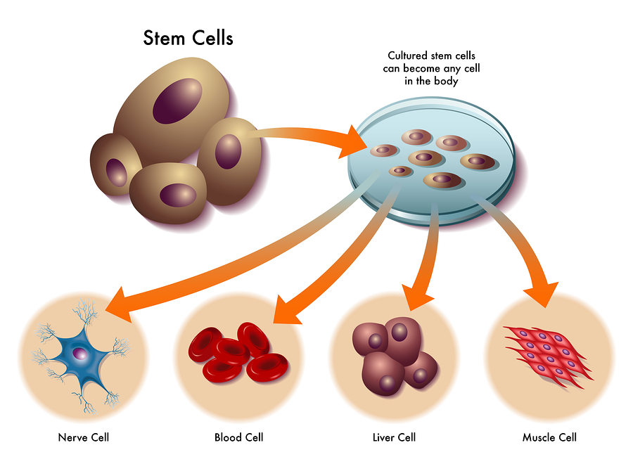 stem cell therapy
